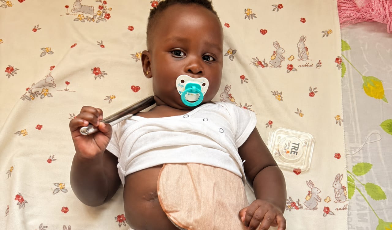 One more surgery, a lifetime of smiles — photo 2