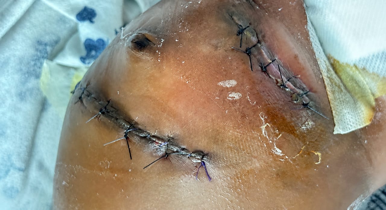 One more surgery, a lifetime of smiles — photo 3